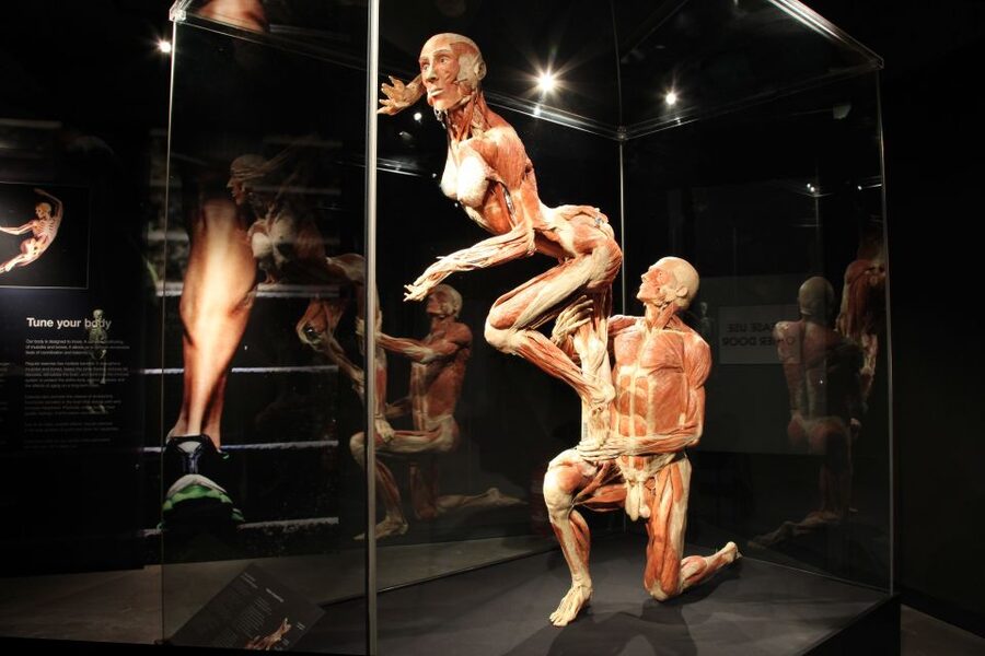 Amsterdam: Body Worlds Exhibition and Canal Cruise - The Happiness Project: what you’ll see in Body Worlds